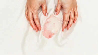 Kan Lekesini Çıkaran Soğuk Su ve Tuz Yöntemi